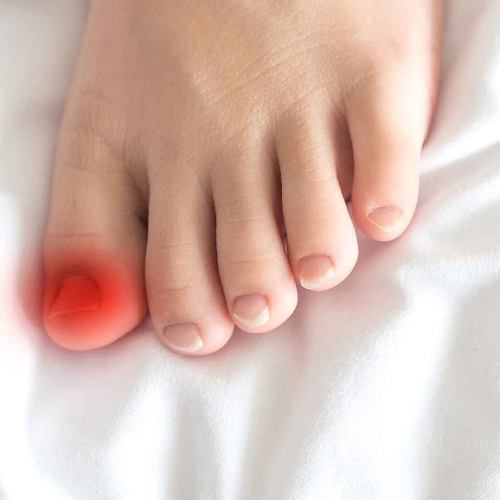 Toe Pain Causes, Symptoms, and Treatment Options